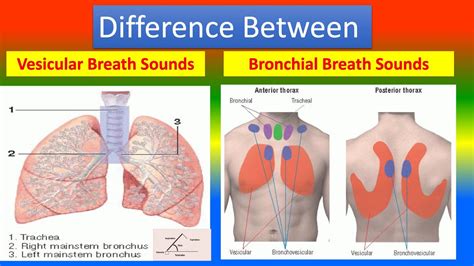 vesicular breathing sounds probably result from ________.